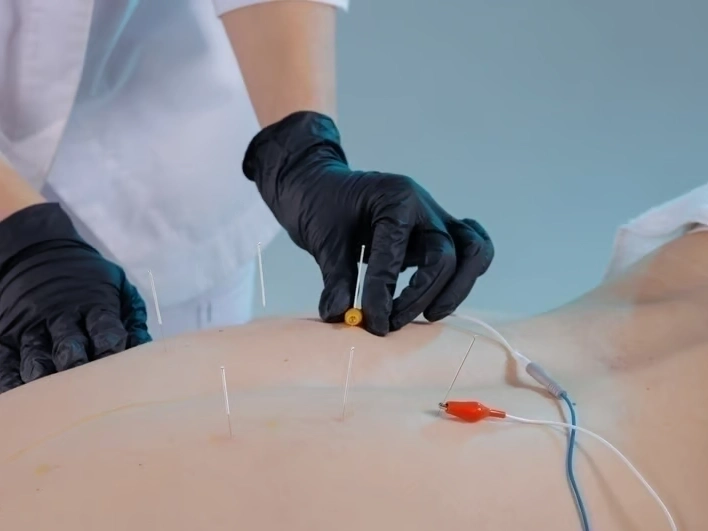 Premier Injury Specialists step-by-step service process — professional quality from start to finish