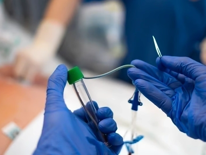 Professional Radiofrequency Ablation Therapy services by Premier Injury Specialists in Stockbridge, GA — licensed Injury Specialists provider